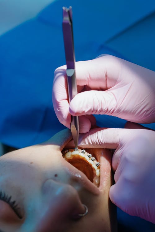 A dental expert adjusting teeth braces