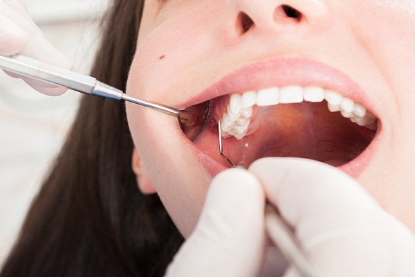 Ongoing dental treatment